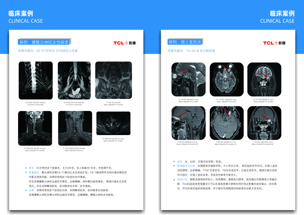 华影门诊部核磁共振检查部位