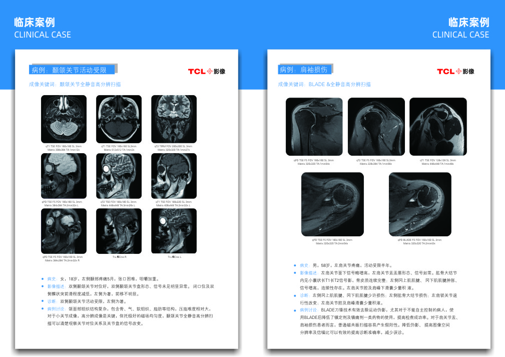 华影门诊部核磁共振检查部位