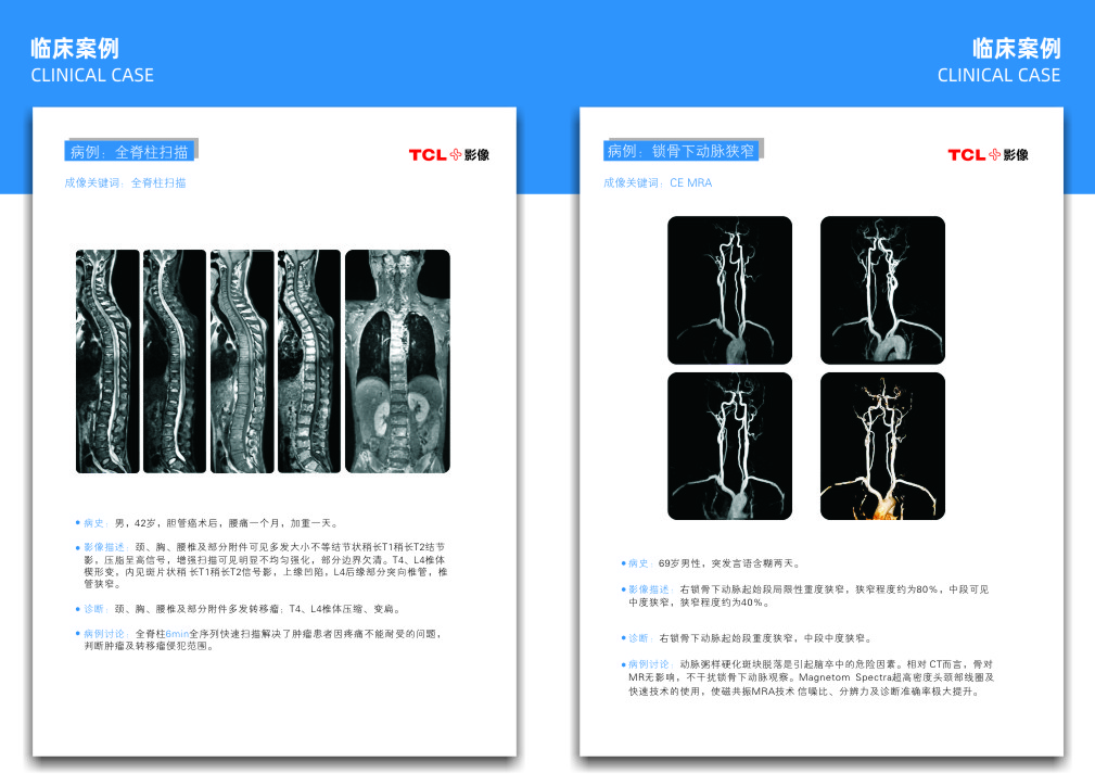 华影门诊部核磁共振检查部位